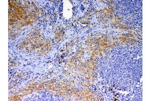 IHC analysis of CD40L using anti-CD40L antibody .