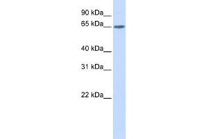 WB Suggested Anti-YTHDF3 Antibody Titration: 0. (YTHDF3 anticorps  (N-Term))