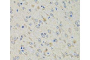 Immunohistochemistry of paraffin-embedded Mouse brain using RAE1 Polyclonal Antibody at dilution of 1:100 (40x lens).