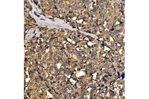 IHC analysis of SRP72 using anti-SRP72 antibody (ABIN7601648).