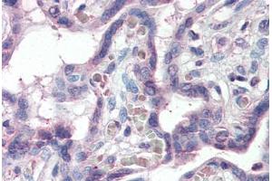 Human Placenta (formalin-fixed, paraffin-embedded) stained with SLC12A4 antibody ABIN337105 at 5 ug/ml followed by biotinylated anti-goat IgG secondary antibody ABIN481715, alkaline phosphatase-streptavidin and chromogen. (SLC12A4 anticorps  (AA 997-1007))