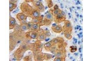 Used in DAB staining on fromalin fixed paraffin-embedded Liver tissue (Emilin1 anticorps  (AA 803-1016))