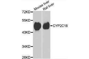 Western blot analysis of extracts of various cell lines, using CYP2C18 antibody. (CYP2C18 anticorps  (AA 231-490))