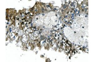 IHC analysis of UBR2 using anti-UBR2 antibody (ABIN7599609). (UBR2 anticorps  (AA 10-664))