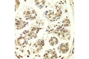 Immunohistochemistry of paraffin-embedded human breast using PRPF3 Antibody. (PRPF3 anticorps  (AA 1-280))