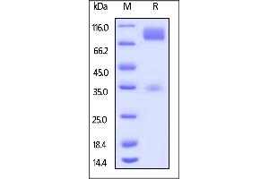 Mouse CD155, Mouse IgG2a Fc Tag on  under reducing (R) condition.