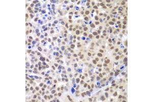 Immunohistochemistry of paraffin-embedded mouse cancer using LHX4 antibody (ABIN6128183, ABIN6143193, ABIN6143194 and ABIN6224097) at dilution of 1:100 (40x lens).