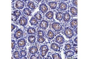 anti-Mucin 5AC, Oligomeric Mucus/gel-Forming (MUC5AC) (AA 4848-5030) antibody