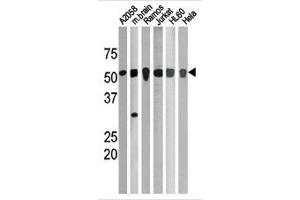 Image no. 1 for anti-Checkpoint Kinase 1 (CHEK1) (pSer280) antibody (ABIN358108) (CHEK1 anticorps  (pSer280))