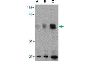 Western blot analysis of MAPKAP1 in human skeletal muscle tissue lysate with MAPKAP1 polyclonal antibody  at (A) 0. (MAPKAP1 anticorps  (N-Term))