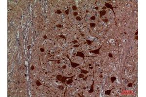 Immunohistochemistry (IHC) analysis of paraffin-embedded Rat Brain, antibody was diluted at 1:100. (Hexosaminidase A anticorps  (Internal Region))