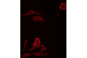 ABIN6269249 staining RAW264. (STAT5A anticorps)
