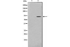 Western blot analysis on HeLa cell lysate using PHF1 Antibody. (PHF1 anticorps  (Internal Region))