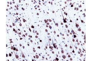 Immunohistochemical staining of pyrimidal cells in a rat cortex, formalin-fixed paraffin-embedded tissue section, with citrate pre-treatment (magnification, 20X) (center). (SNRPN anticorps  (AA 14-174))