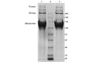 SDS PAGE Results of Bovine Collagen Type II.