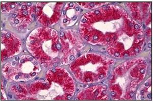 Human Kidney, Tubules: Formalin-Fixed, Paraffin-Embedded (FFPE)
