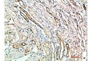 Immunohistochemical analysis of paraffin-embedded human-kidney, antibody was diluted at 1:200