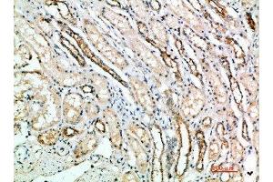 Immunohistochemical analysis of paraffin-embedded human-kidney, antibody was diluted at 1:200 (ART4 anticorps  (AA 181-230))