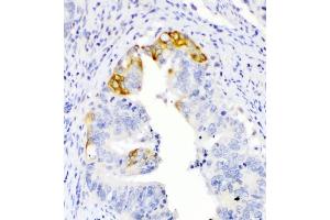 IHC analysis of TL1A using anti-TL1A antibody (ABIN5693289).
