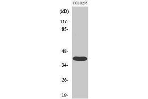 Western Blotting (WB) image for anti-Mitogen-Activated Protein Kinase-Activated Protein Kinase 3 (MAPKAPK3) (C-Term) antibody (ABIN3173584) (MAPKAP Kinase 3 anticorps  (C-Term))