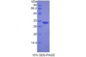 SDS-PAGE analysis of Mouse APAF1 Protein.