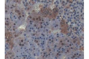 DAB staining on IHC-P; Samples: Rat Adrenal gland Tissue (PLSCR4 anticorps  (AA 1-299))