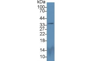 Detection of PEX2 in Rat Cerebrum lysate using Polyclonal Antibody to Peroxisomal Biogenesis Factor 2 (PEX2)