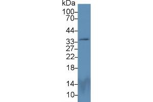 Detection of PEX2 in Rat Cerebrum lysate using Polyclonal Antibody to Peroxisomal Biogenesis Factor 2 (PEX2) (PEX2 anticorps  (AA 233-305))