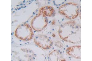 Used in DAB staining on fromalin fixed paraffin- embedded Kidney tissue (GFM1 anticorps  (AA 1-158))