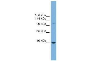 ST14 antibody used at 1 ug/ml to detect target protein. (ST14 anticorps)