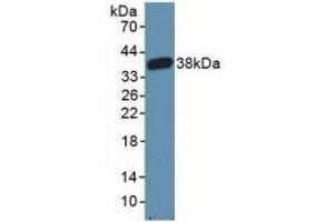Detection of Recombinant CARD9, Mouse using Polyclonal Antibody to Caspase Recruitment Domain Family, Member 9 (CARD9) (CARD9 anticorps  (AA 274-530))