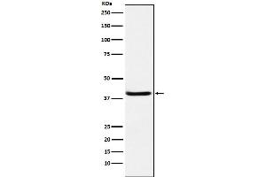 Western blot analysis of SerpinB3 expression in A431 cell lysate.