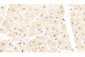 Detection of IL1RL1 in Human Cardiac Muscle Tissue using Polyclonal Antibody to Interleukin 1 Receptor Like Protein 1 (IL1RL1) (IL1RL1 anticorps  (AA 162-349))