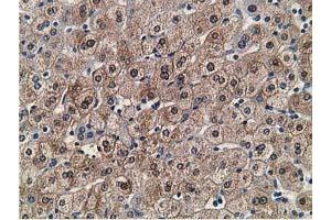 Immunohistochemical staining of paraffin-embedded Human liver tissue using anti-FLYWCH2 mouse monoclonal antibody. (FLYWCH2 anticorps)