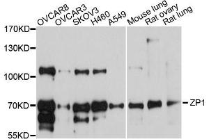 Western blot analysis of extracts of various cell lines, using ZP1 antibody (ABIN5999216) at 1/1000 dilution. (ZP1 anticorps)