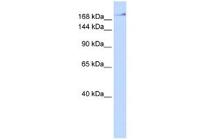 WB Suggested Anti-ZMYM4 Antibody Titration:  0. (ZMYM4 anticorps  (N-Term))