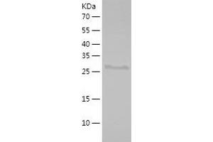 alpha-Methylacyl-CoA Racemase (AMACR) (AA 171-382) protein (His tag)