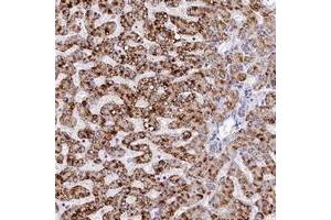 Immunohistochemical staining of human liver with SPINK9 polyclonal antibody  shows strong cytoplasmic positivity in hepatocytes at 1:20-1:50 dilution. (SPINK9 anticorps)