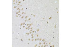 Immunohistochemistry of paraffin-embedded rat brain using SNRPA Antibody. (SNRPA1 anticorps  (AA 1-282))