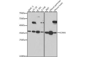 Western blot analysis of extracts of various cell lines, using KCNK6 antibody (ABIN7269467) at 1:1000 dilution. (KCNK6 anticorps  (AA 254-313))