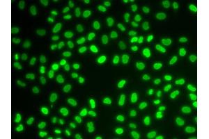 Immunofluorescence (IF) image for anti-Hepatoma-Derived Growth Factor (HDGF) antibody (ABIN1876535) (HDGF anticorps)
