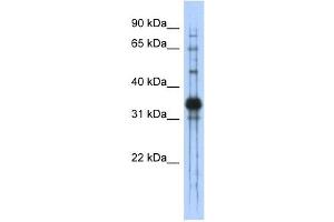 Chondroadherin antibody used at 1 ug/ml to detect target protein. (CHAD anticorps  (Middle Region))