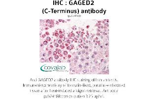 Image no. 2 for anti-X Antigen Family, Member 1B (XAGE1B) (C-Term) antibody (ABIN1734558) (XAGE1B/GAGED2 anticorps  (C-Term))