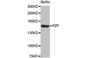 Western blot analysis of extracts of BeWo cell line, using PZP antibody. (PZP anticorps  (AA 620-740))