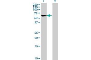 Western Blot analysis of FANCC expression in transfected 293T cell line by FANCC MaxPab polyclonal antibody. (FANCC anticorps  (AA 1-558))