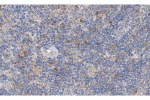 ABIN6266885 at 1/100 staining human lymph node tissue sections by IHC-P. (EGR1 + EGR2 anticorps)