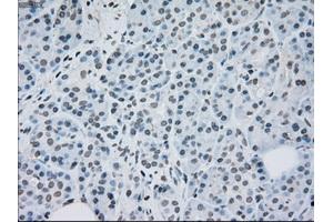Immunohistochemical staining of paraffin-embedded lung tissue using anti-MAP2K2mouse monoclonal antibody. (MEK2 anticorps)