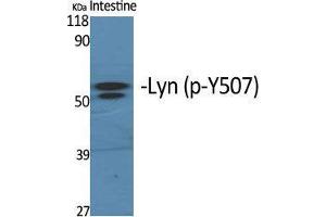 Western Blot (WB) analysis of specific cells using Phospho-Lyn (Y508) Polyclonal Antibody. (LYN anticorps  (pTyr508))