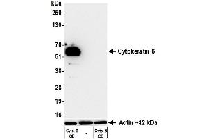 Western Blotting (WB) image for anti-Keratin 6 (KRT6) (C-Term) antibody (ABIN7795792)