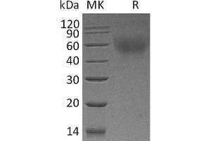 Western Blotting (WB) image for Tumor Necrosis Factor Receptor Superfamily, Member 8 (TNFRSF8) protein (His tag) (ABIN7320665) (TNFRSF8 Protein (His tag))